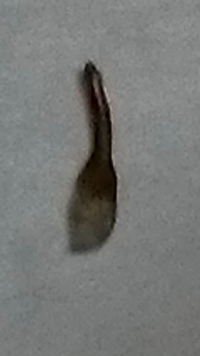 この前腕の飛び出てるちっちゃい角栓みたいなのを取ったらこんなものが出てきました 大きさは長さが3～5mm
太さはシャー芯の0，5mmより細いです
これはなんだとともいますか？
しょうじきこわいです