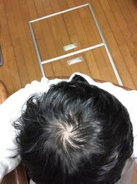 軟毛 ハゲですか また軟毛は悪いことですか Yahoo 知恵袋