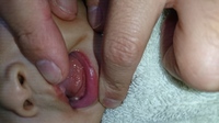 赤ちゃんの口の中に６ヶ月の息子の 舌の裏 なかなかみせてくれないので あまりは Yahoo 知恵袋