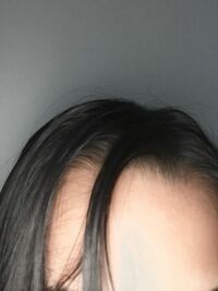 髪の生え方についてです 前髪が真上に向かって生えてしまっているの Yahoo 知恵袋