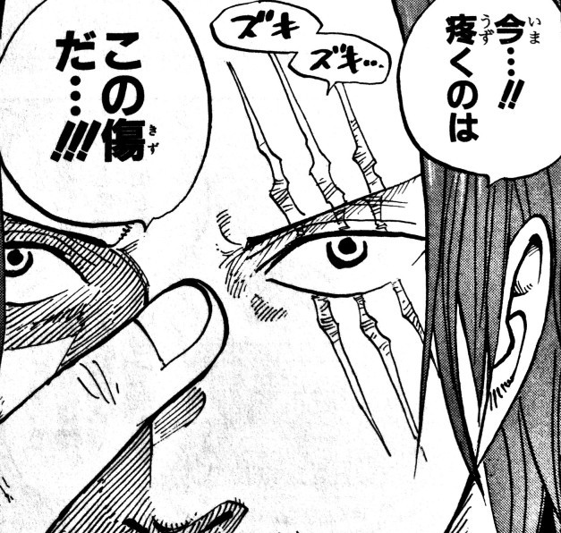 ワンピースの黒ひげって シャンクスに傷をつけるほどの強さで Yahoo 知恵袋