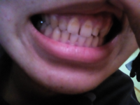 汚い画像すみません 見ての通り 歯が黄色いですずっと歯磨きサボったか Yahoo 知恵袋