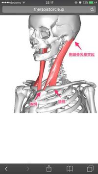 首が痛いです 場所は 自分から見て右側の下らへんです 画像でいうと Yahoo 知恵袋