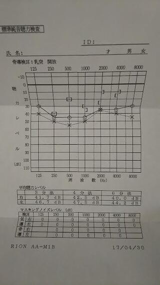 多い 聞き 間違い が