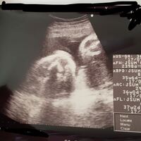 明日から臨月に入る妊婦です お腹の赤ちゃんの性別についてなのですが ７ヶ月に入 Yahoo 知恵袋