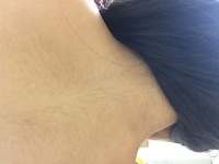 背中の毛についてです もーすぐ 祭りがあるんですが 背中の見える服を着 Yahoo 知恵袋