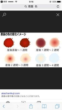 産後４週間です ２日間くらい悪露が黄色だったのですが今日朝から画像 Yahoo 知恵袋