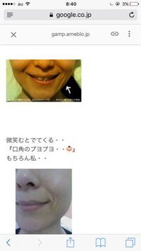えくぼ 筋肉 シワ ニコっと笑うと 口の横 いわゆる ほう Yahoo 知恵袋