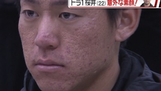 ジャイアンツの桜井選手の肌大丈夫でしょうか これはニキビ Yahoo 知恵袋