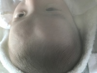 赤ちゃんのおでこは柔らかいですか 生後4ヶ月の娘がいます Yahoo 知恵袋