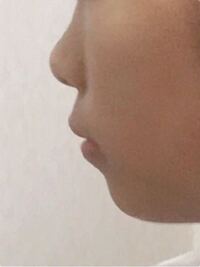 舌回しトレーニングについて ほうれい線を改善するために Yahoo 知恵袋