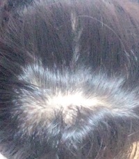 薄毛に困っています 私は中学生なのですが髪の毛が細くボリュームがありま Yahoo Beauty