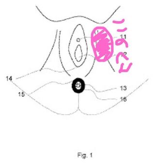 緊急 膣口 会陰部 が痛いです イラスト貼っておきます 軽く閲覧注意で Yahoo 知恵袋