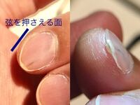 10年ほど前から人差し指の爪に黒い線があり その先端は二重爪の Yahoo 知恵袋