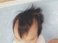 生後1ヶ月の赤ちゃんのおでこが M字ハゲなのは大丈夫ですか 女の子だし Yahoo 知恵袋
