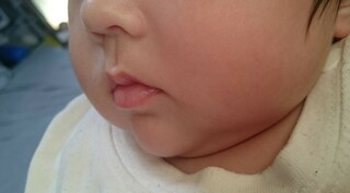 生後2ヶ月の赤ちゃんです顎が出てる のかなと心配に思っています Yahoo 知恵袋