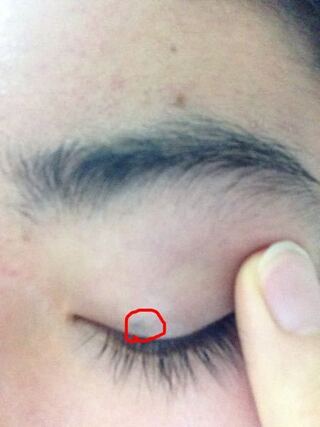 つかまえる センチメートル 終わり 左 まぶた ほくろ Oceangeodivers Com
