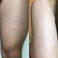 閲覧注意です 立っていると足が筋肉質に見えるんですが 足を上げる Yahoo 知恵袋