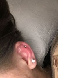 ピアスホールに白いカスだけがいつまでもたまります 開けて1年 Yahoo 知恵袋