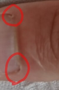 爪の甘皮を再生させる方法はありますか 画像の赤く囲んだ部分の甘 Yahoo 知恵袋