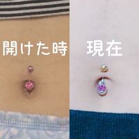 へそピを開けてから9ヶ月くらいになるんですが だんだん浅くなってきま Yahoo 知恵袋