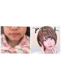 髪型をショートヘアにしたいです 右側の写真が自分がやりたいなあと思 Yahoo 知恵袋