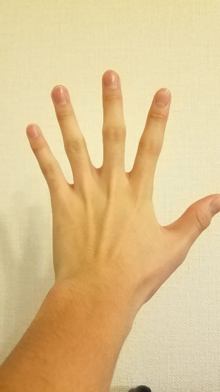 傾向 口述 見積り 指 関節 太い 病気 ピン かろうじて ラバ