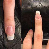 私の爪は 放っておくと真っ直ぐじゃなくて斜めに歪んで伸びてしまうんですよ Yahoo 知恵袋