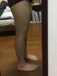 脚やせしたいですx脚で骨盤が斜めで筋肉太りかと思いきや筋肉の上に脂肪が乗ってる Yahoo 知恵袋