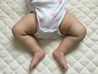 赤ちゃんの股関節脱臼について 生後3ヶ月の娘がいます2歳の息子もいて4ヶ Yahoo 知恵袋