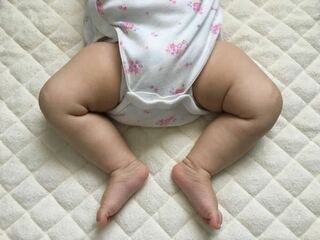 股関節脱臼について 生後3ヶ月の娘ですが太もものシワが左右 Yahoo 知恵袋