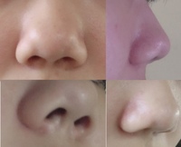 鼻が大きいって容姿をかなり左右しますよね 私は鼻が大きめでもう少し 主張しない Yahoo 知恵袋