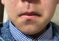 汚い写真ごめんなさい 15歳の男子中学生です 一日髭を剃らなかっ Yahoo 知恵袋