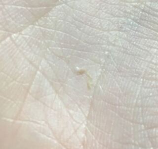 半年前から眼球に白い筋のようなものが付いていて瞼がゴロゴロしま Yahoo 知恵袋