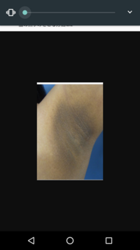 中学生の子供の脇の黒ずみが気になりますまだ脇毛もはえてないんで Yahoo 知恵袋