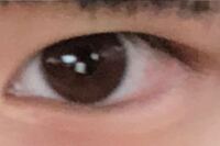 一重のまま目を大きくする手術の方法を教えてください 一重の男です 一重 Yahoo 知恵袋