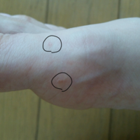 アリに刺されてチクッとして痛い と言ったらアリは刺すんじゃなくてかむのだとい Yahoo 知恵袋