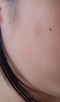 同じ場所にまたしこり 今日顔を触ったら頬にしこりがありました Yahoo 知恵袋