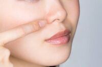 ここ数日鼻の側面を軽く押すと痛みが生じます この痛みはニキ Yahoo 知恵袋