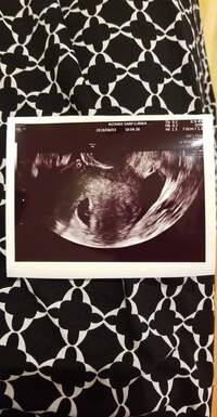 現在6w4dです 生理予定日から計算して 経産婦なのですが 今回のお医 Yahoo 知恵袋