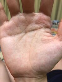 右手の薬指に スター線らしきものが あります スター線ですか Yahoo 知恵袋