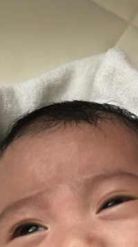 赤ちゃんの寝起きの一重瞼 腫れ むくみについて３ヶ月になる息子がいます Yahoo 知恵袋