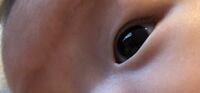 赤ちゃんの一重まぶた 二重まぶた 知恵袋 の回答に 生まれた時は一 Yahoo 知恵袋