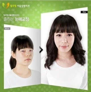 結局は 韓国女って こんなのばっかりなんでしょうか 整形前と整 Yahoo 知恵袋