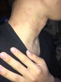 アレルギー体質です 生まれた頃から重度のアレルギーで卵や米や乳製品などが Yahoo 知恵袋