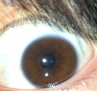 瞳の柄でパーソナルカラー診断できると聞いたのですが これだとどれになるの Yahoo 知恵袋