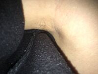 小5で脇毛が生えてきたんですけど早いですか？ 