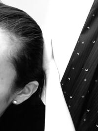 生まれつき生え際がm字ハゲのように 剃り込みのようになっ Yahoo 知恵袋