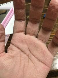 お 風呂 上がり 手のひら かゆい 面白い ニュース