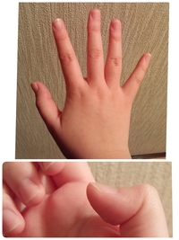 男性の方 ご意見ください 指の太い女性 彼女 をどう思います Yahoo 知恵袋